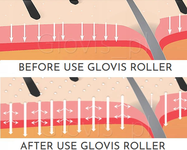 Glovis Roller